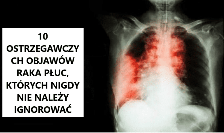 10_ostrzegawczych_objaw_w_raka_p_uc__kt_re_ka_dy_powinien_zna_