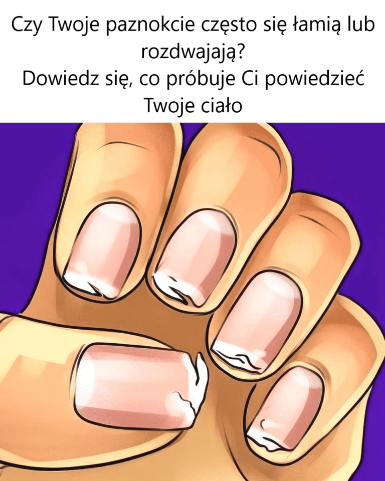 Czy_Twoje_paznokcie_ci_gle_p_kaj__lub_rozdwajaj__si___To_jest_wiadomo____kt_r__pr_buje_ci_wys_a__twoje_cia_o