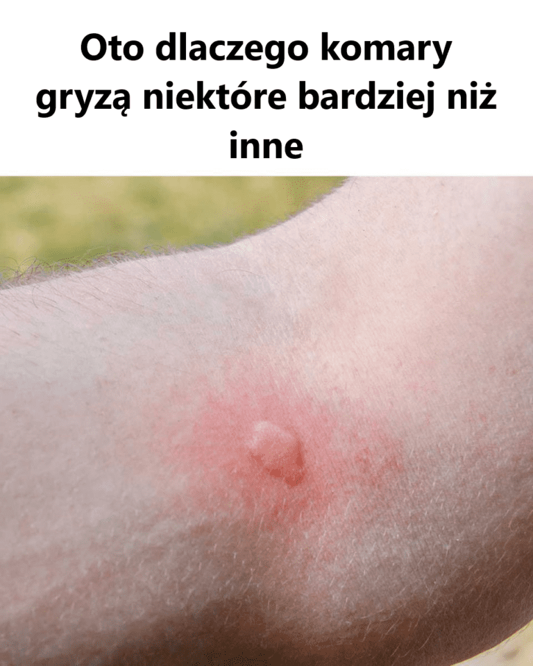 Dlaczego_komary_wol__niekt_rych_ludzi_od_innych__Wyja_nienie_naukowe