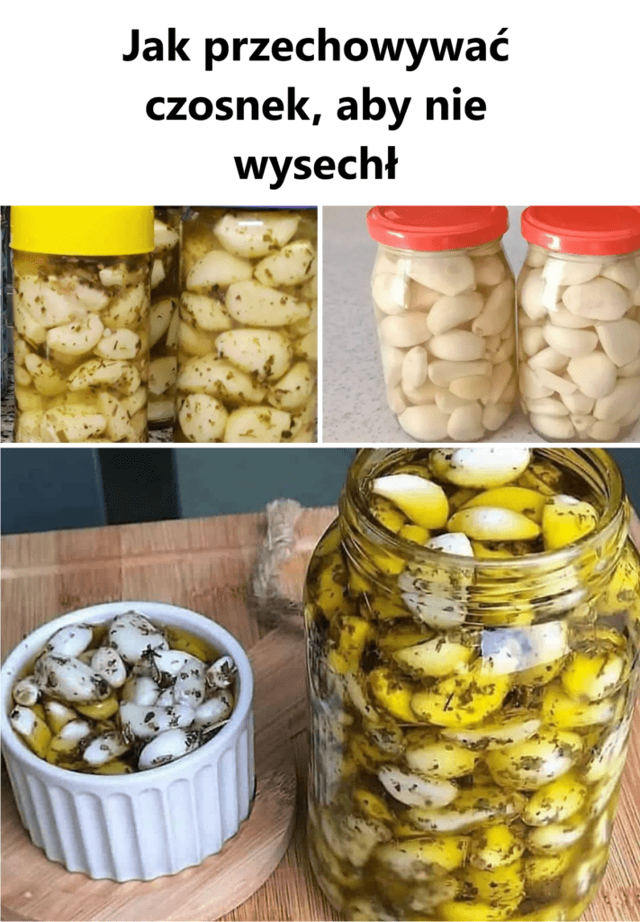 Jak_przechowywa__czosnek__aby_nie_wysech_ Jak_przechowywa__czosnek__aby_nie_wysech_