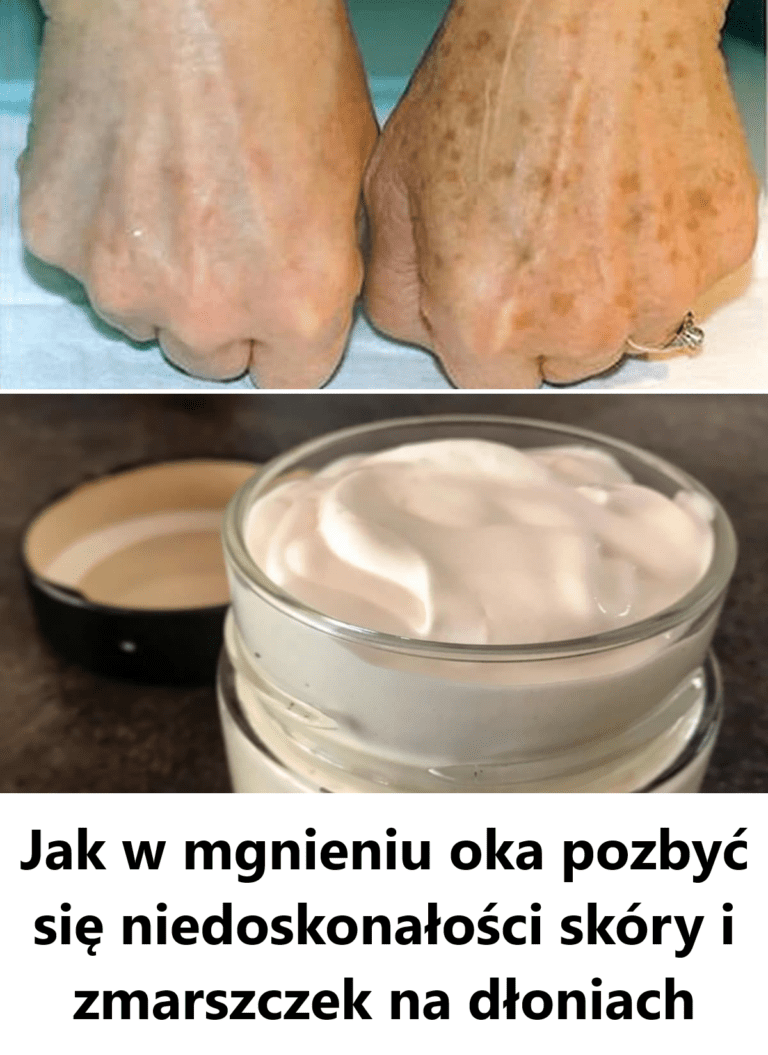 Jak_w_mgnieniu_oka_pozby__si__niedoskona_o_ci_sk_ry_i_zmarszczek_na_d_oniach