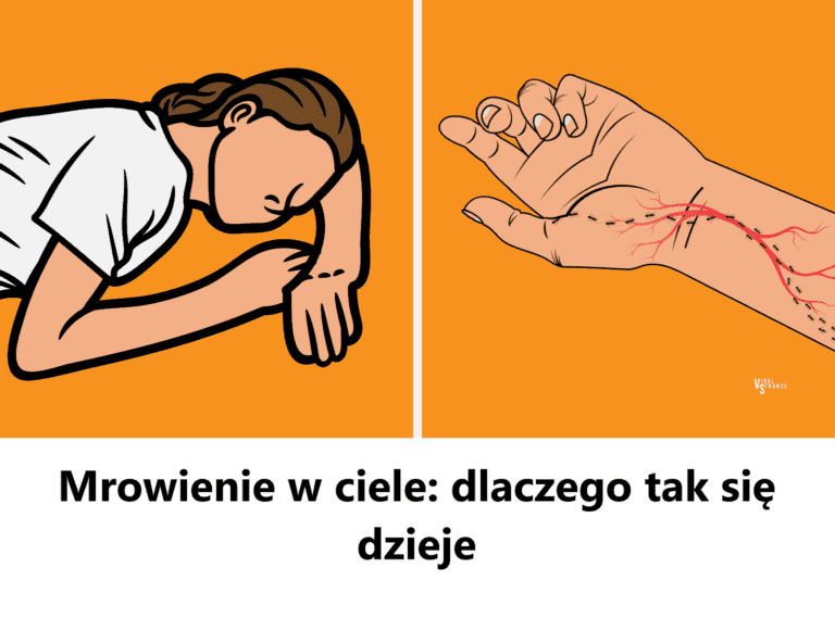 Mrowienie_w_ciele__dlaczego_tak_si__dzieje
