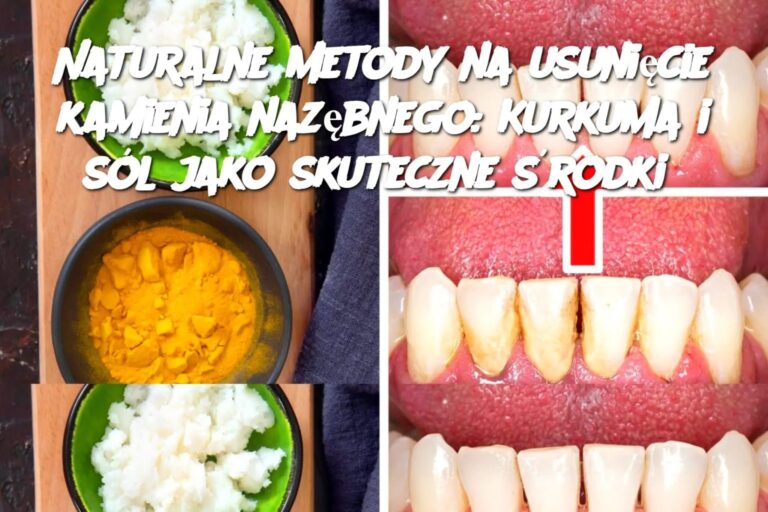 Naturalne_metody_na_usuni_cie_kamienia_naz_bnego__Kurkuma_i_s_l_jako_skuteczne__rodki