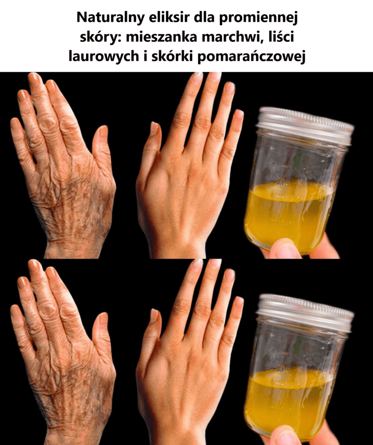 Naturalny_eliksir_dla_promiennej_sk_ry__mieszanka_marchwi__li_ci_laurowych_i_sk_rki_pomara_czowej