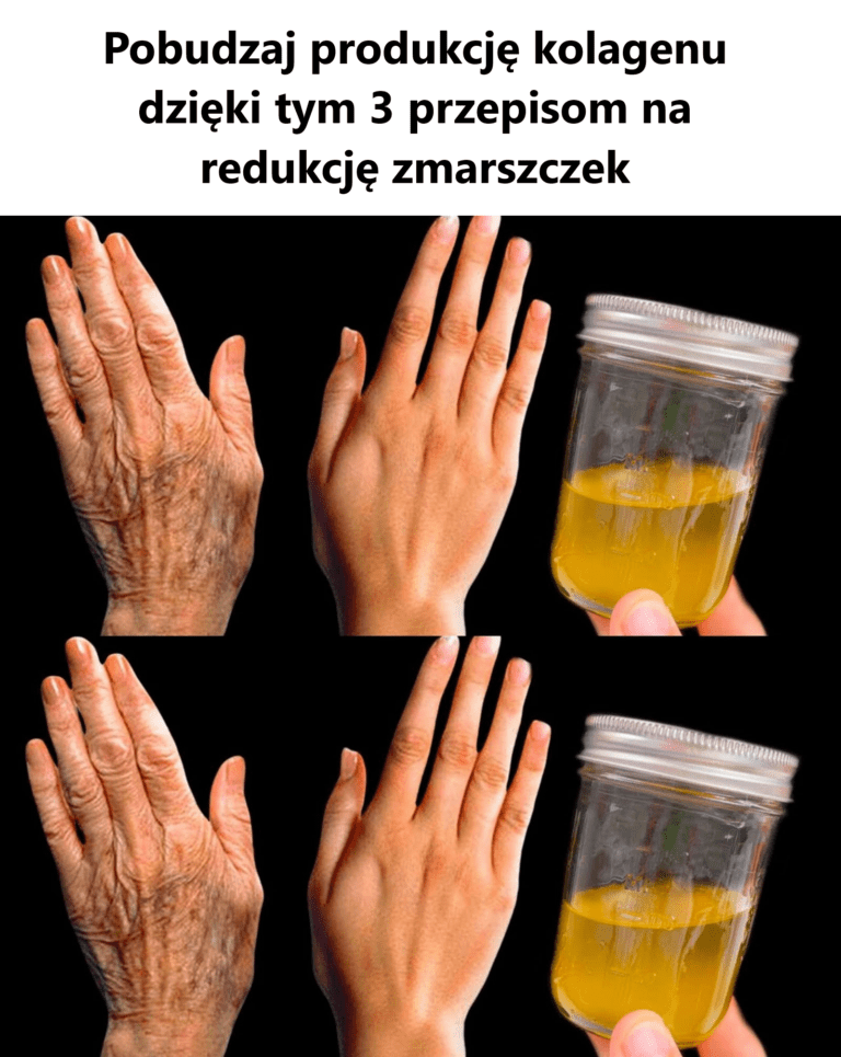 Pobudzaj_produkcj__kolagenu_dzi_ki_tym_3_przepisom_na_redukcj__zmarszczek
