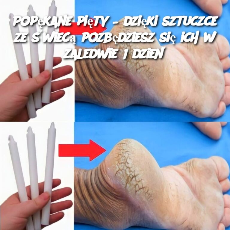 Pop_kane_pi_ty___dzi_ki_sztuczce_ze__wiec__pozb_dziesz_si__ich_w_zaledwie_1_dzie_