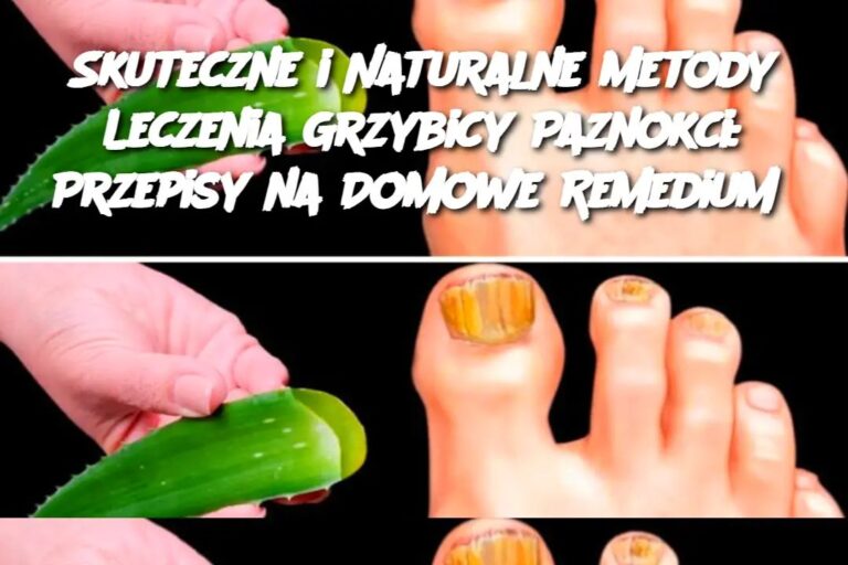 Skuteczne_i_Naturalne_Metody_Leczenia_Grzybicy_Paznokci__Przepisy_na_Domowe_Remediu