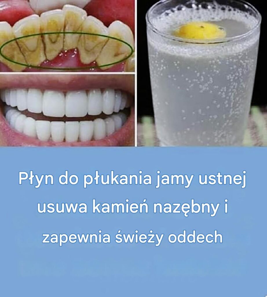 Ten_p_yn_do_p_ukania_jamy_ustnej_naturalnie_usuwa_kamie__naz_bny