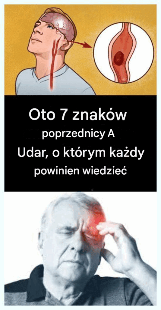 7_niesamowicie_prawdziwych_objaw_w_ostrzegawczych_udaru_m_zgu_ 7_niesamowicie_prawdziwych_objaw_w_ostrzegawczych_udaru_m_zgu_