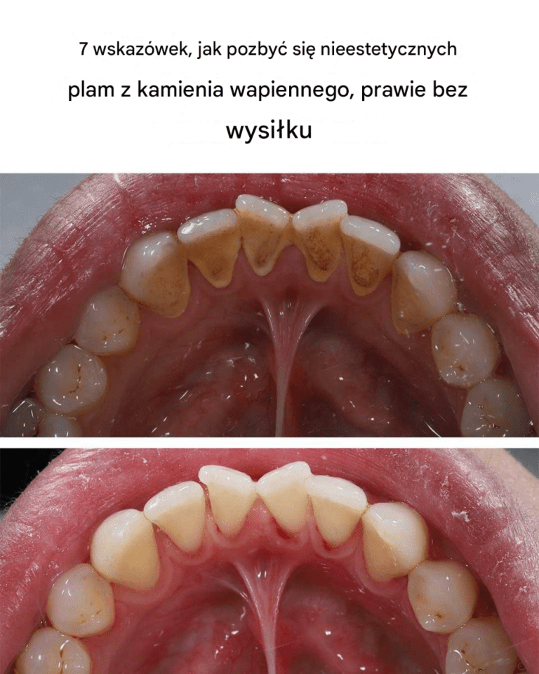 7_wskaz_wek__jak_pozby__si__nieestetycznych_plam_z_kamienia_wapiennego__prawie_bez_wysi_ku