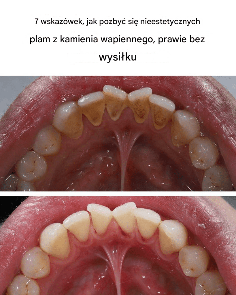 7_wskaz_wek__jak_pozby__si__nieestetycznych_plam_z_kamienia_wapiennego__prawie_bez_wysi_ku