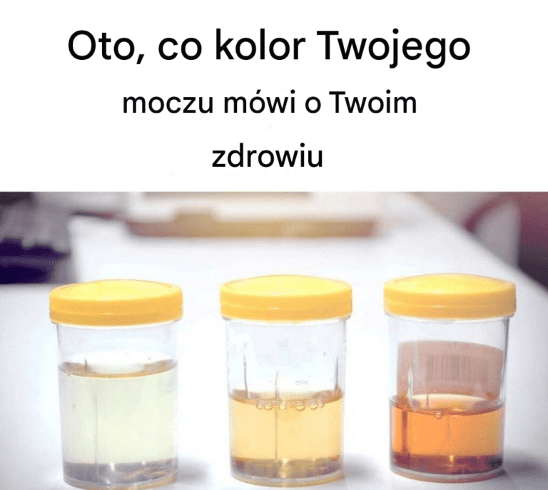 Co_kolor_moczu_m_wi_o_Twoim_zdrowiu