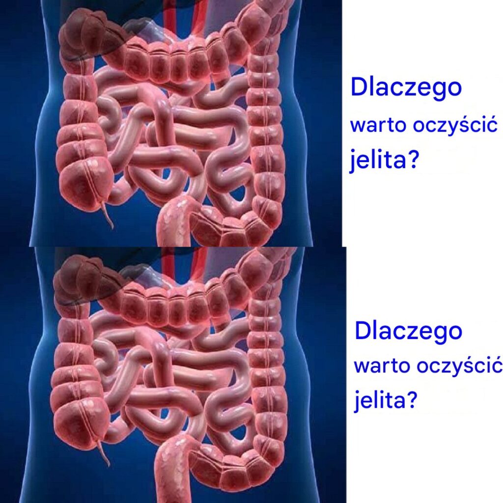 Cz_sto_zadawane_pytania__Dlaczego_warto_oczy_ci__jelita_ Cz_sto_zadawane_pytania__Dlaczego_warto_oczy_ci__jelita_