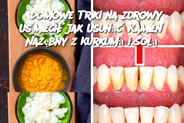 Domowe_Triki_na_Zdrowy_U_miech__Jak_Usun___Kamie__Naz_bny_z_Kurkum__i_Sol_