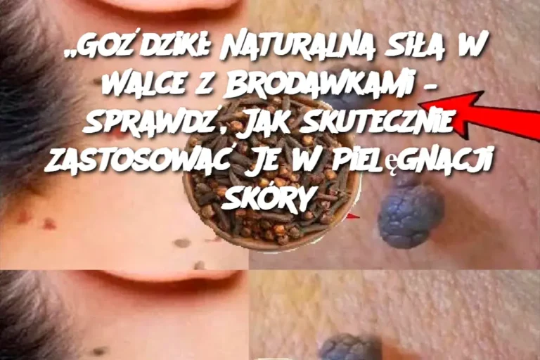 Go_dziki__Naturalna_Si_a_w_Walce_z_Brodawkami___Sprawd___Jak_Skutecznie_Zastosowa__Je_w_Piel_gnacji_Sk_ry