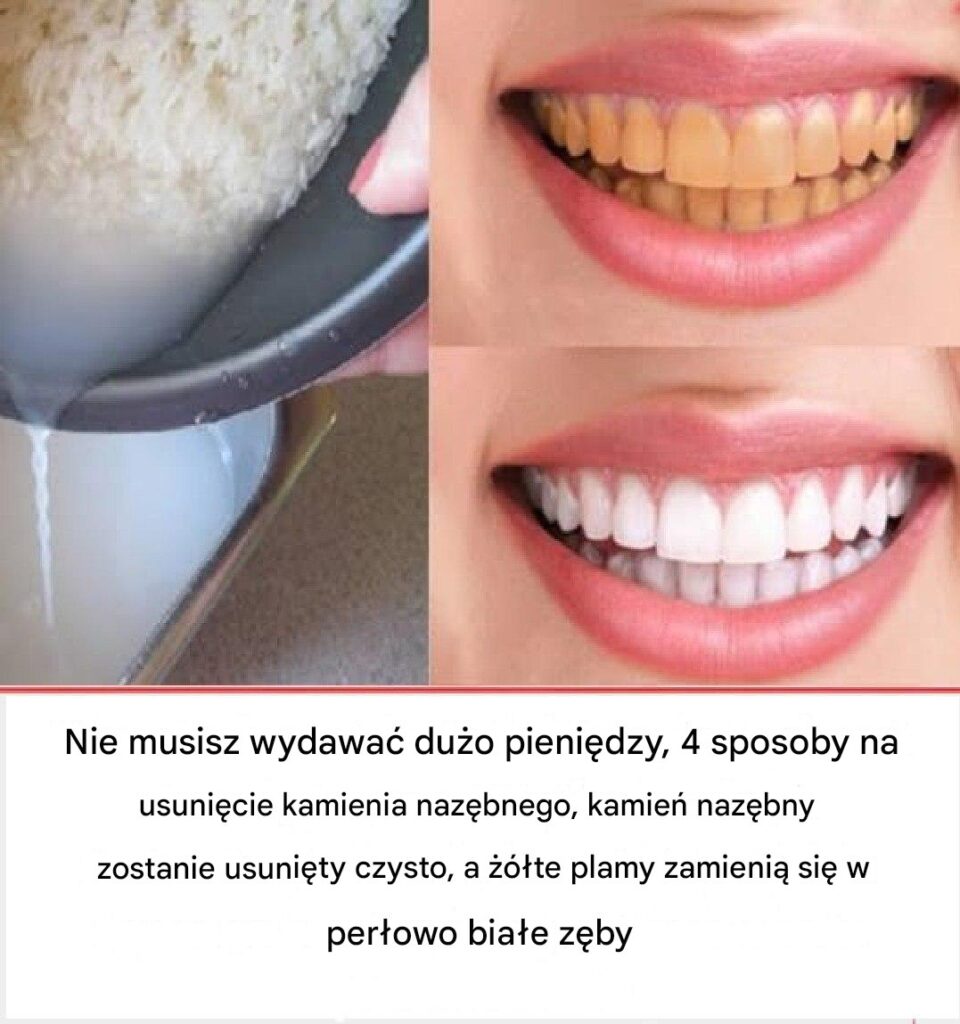 Jak_dba__o_z_by_i_oszcz_dza__pieni_dze_na_wizytach_u_dentysty___domowe_sposoby_na_zdrowy_u_miech Jak_dba__o_z_by_i_oszcz_dza__pieni_dze_na_wizytach_u_dentysty___domowe_sposoby_na_zdrowy_u_miech
