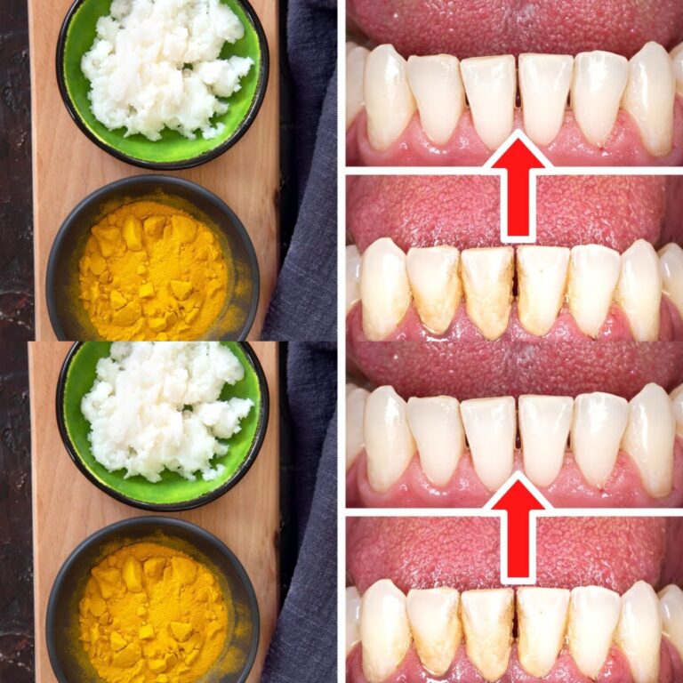 Jak_usun___kamie__i_osad_naz_bny_bez_dentysty__kurkuma_i_s_l