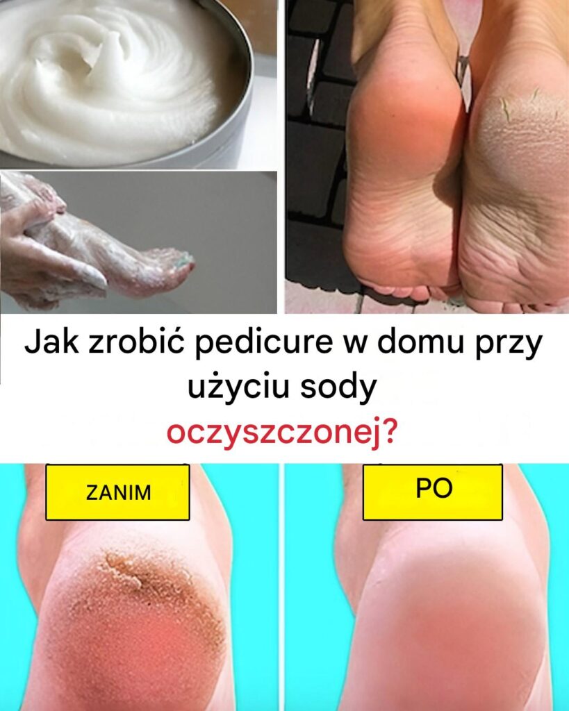 Jak_zrobi__pedicure_w_domu_przy_u_yciu_sody_oczyszczonej_-1 Jak_zrobi__pedicure_w_domu_przy_u_yciu_sody_oczyszczonej_-1