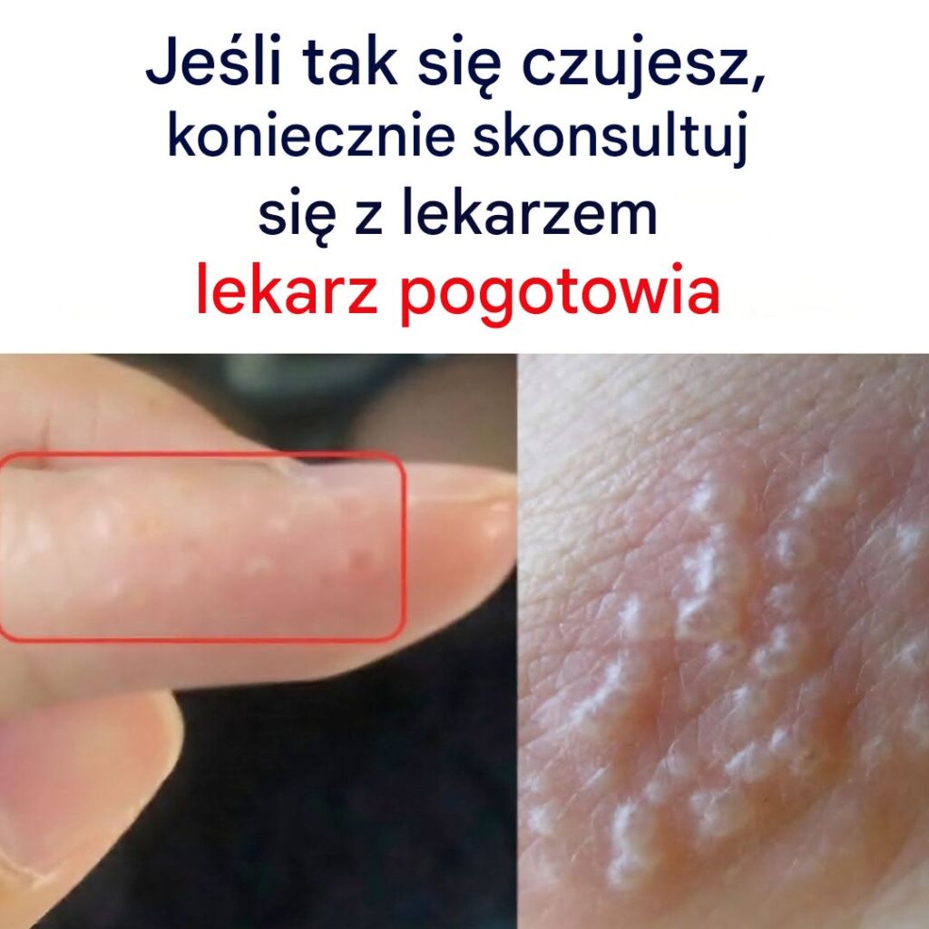 Je_li_zauwa_ysz_te_czerwone_i_bolesne_grudki__mo_esz_cierpie__na_t__chorob__ Je_li_zauwa_ysz_te_czerwone_i_bolesne_grudki__mo_esz_cierpie__na_t__chorob__
