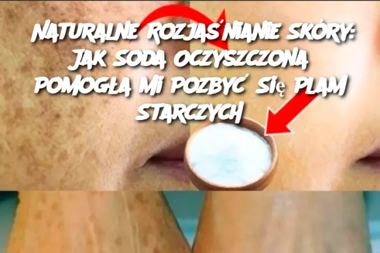 Naturalne_Rozja_nianie_Sk_ry__Jak_Soda_Oczyszczona_Pomog_a_Mi_Pozby__Si__Plam_Starczych