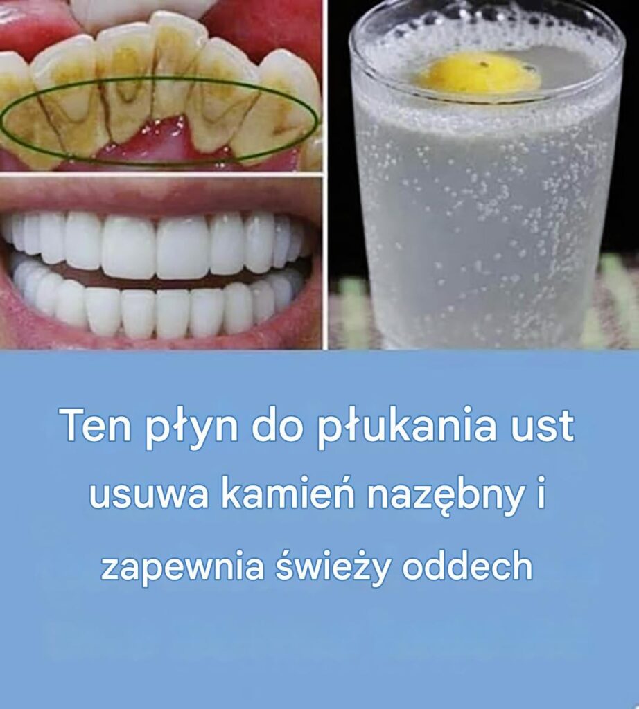 Naturalny_spos_b_na_czyste_i_bia_e_z_by Naturalny_spos_b_na_czyste_i_bia_e_z_by