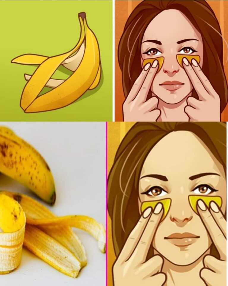 Nie_wyrzucaj_sk_rek_od_banan_w__Oto_7_niezb_dnych_zastosowa___Artyku__znajduje_si__w_pierwszym_komentarzu___