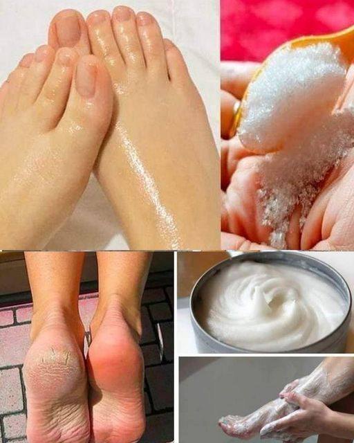 Oto_jak_wykona__pedicure_w_domu_przy_u_yciu_sody_oczyszczonej-3 Oto_jak_wykona__pedicure_w_domu_przy_u_yciu_sody_oczyszczonej-3