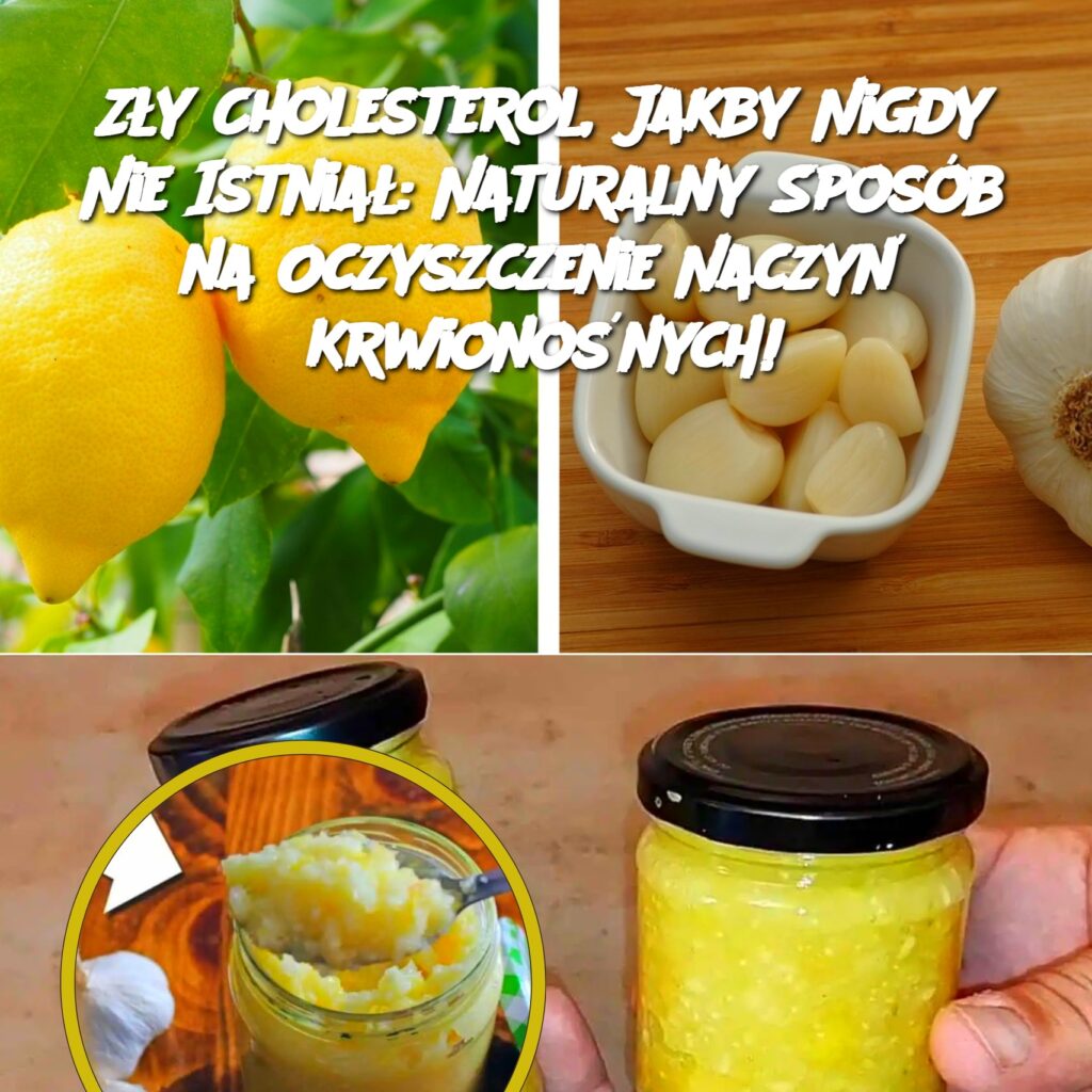 Z_y_Cholesterol__Jakby_Nigdy_Nie_Istnia___Naturalny_Spos_b_na_Oczyszczenie_Naczy__Krwiono_nych_-1 Z_y_Cholesterol__Jakby_Nigdy_Nie_Istnia___Naturalny_Spos_b_na_Oczyszczenie_Naczy__Krwiono_nych_-1