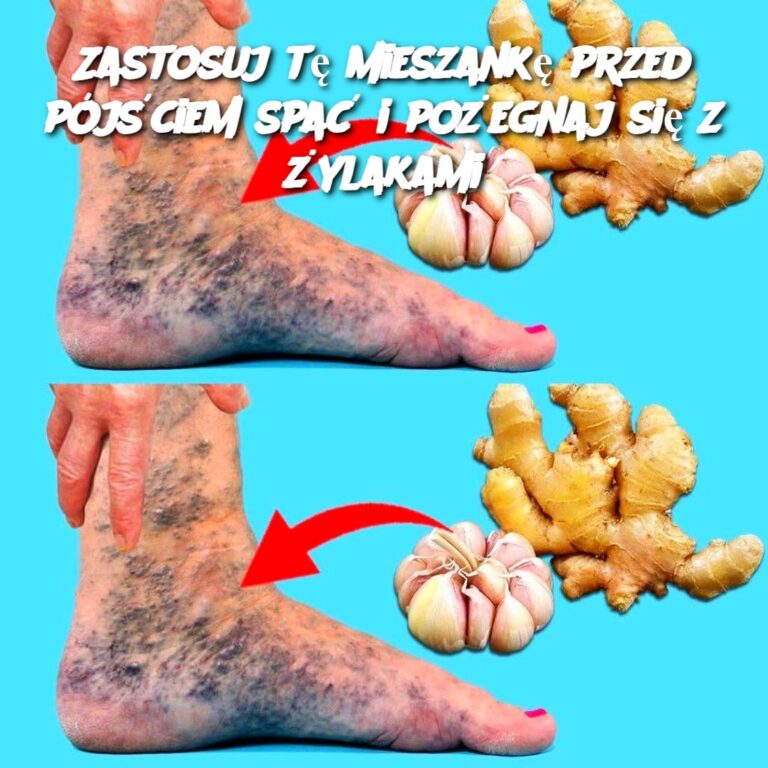 Zastosuj_t__mieszank__przed_p_j_ciem_spa__i_po_egnaj_si__z__ylakami