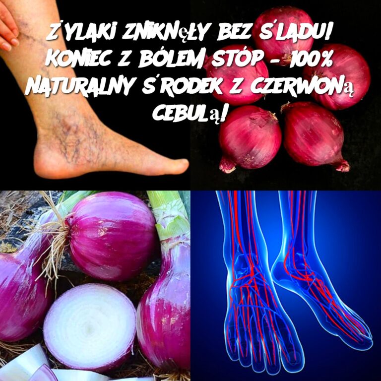 ylaki_znikn__y_bez__ladu__Koniec_z_b_lem_st_p___100__naturalny__rodek_z_czerwon__cebul__