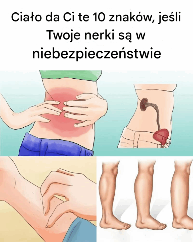 10_objaw_w_choroby_nerek