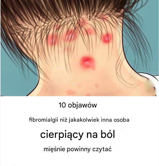 10_objaw_w_fibromialgii__kt_re_ka_dy_z_b_lem_mi__ni_powinien_przeczyta_ 10_objaw_w_fibromialgii__kt_re_ka_dy_z_b_lem_mi__ni_powinien_przeczyta_