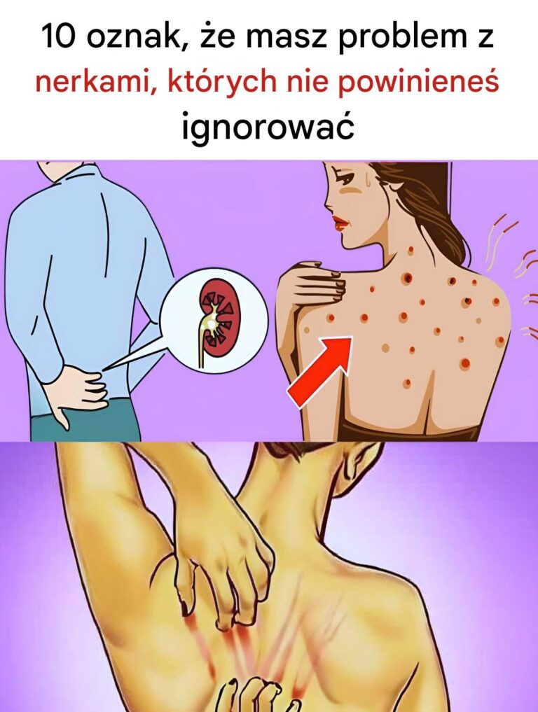 10_oznak_problem_w_z_nerkami