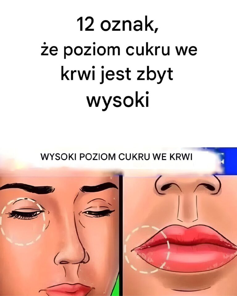 12_oznak___e_masz_wysoki_poziom_cukru_we_krwi-1