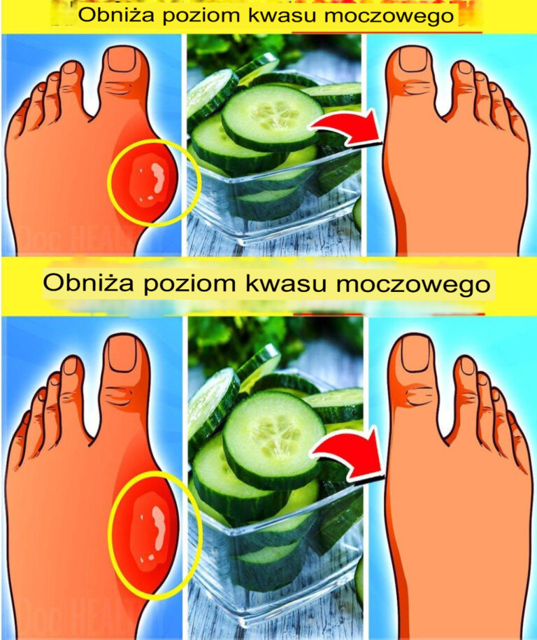 16_Superfoods__kt_re_naturalnie_obni_aj__poziom_kwasu_moczowego