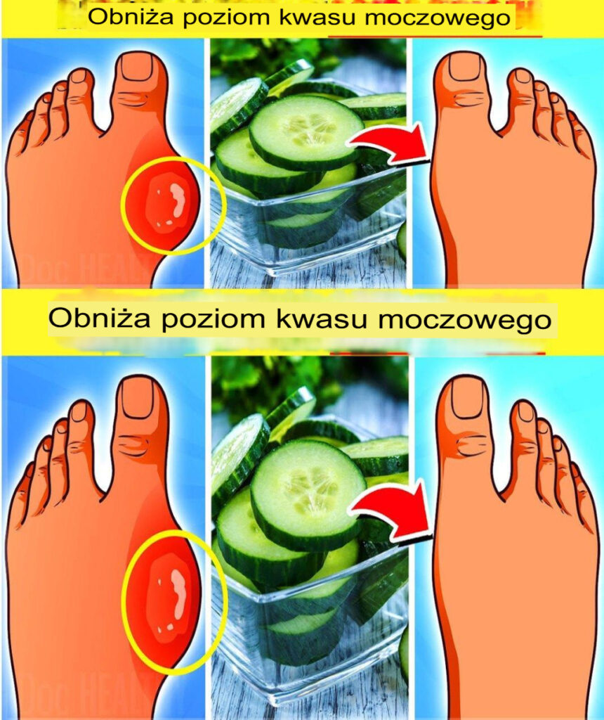 16_Superfoods__kt_re_naturalnie_obni_aj__poziom_kwasu_moczowego 16_Superfoods__kt_re_naturalnie_obni_aj__poziom_kwasu_moczowego