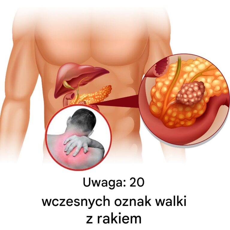 20_wczesnych_oznak___e_Tw_j_organizm_walczy_z_chorob_