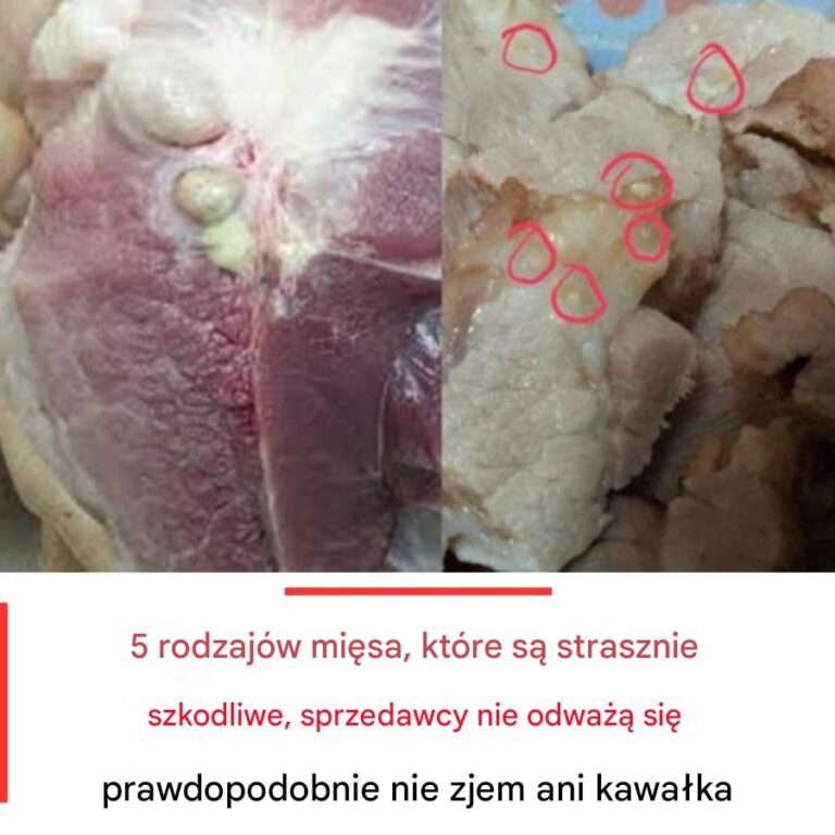 5_rodzaj_w_mi_sa__kt_re_s__strasznie_szkodliwe