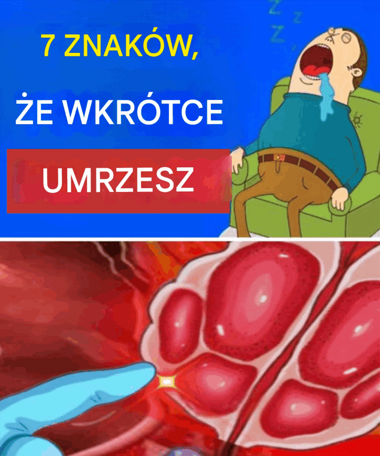 7_oznak___e_wkr_tce_umrzesz