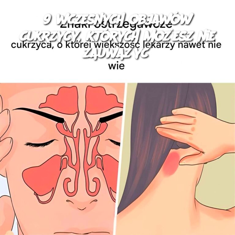 9_wczesnych_objaw_w_cukrzycy__kt_rych_mo_esz_nie_zauwa_y_