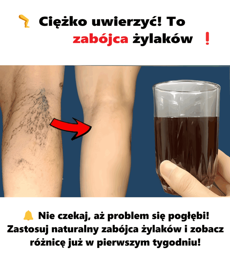 Ci__ko_uwierzy___To_zab_jca__ylak_w__Szybko_pozb_d__si___ylak_w
