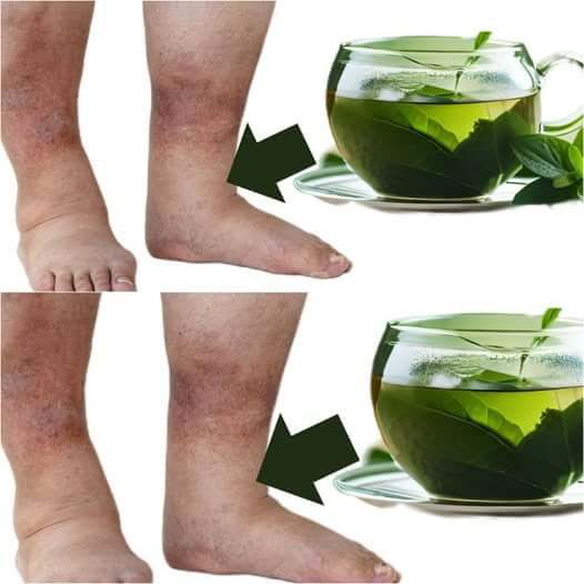 Cudowna_herbata_z_pietruszki__Szybka_i_naturalna_ulga_w_obrz_kach Cudowna_herbata_z_pietruszki__Szybka_i_naturalna_ulga_w_obrz_kach