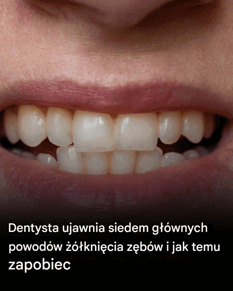 Dentysta_wyja_nia_7_g__wnych_przyczyn____kni_cia_z_b_w_i_jak_temu_zapobiega_