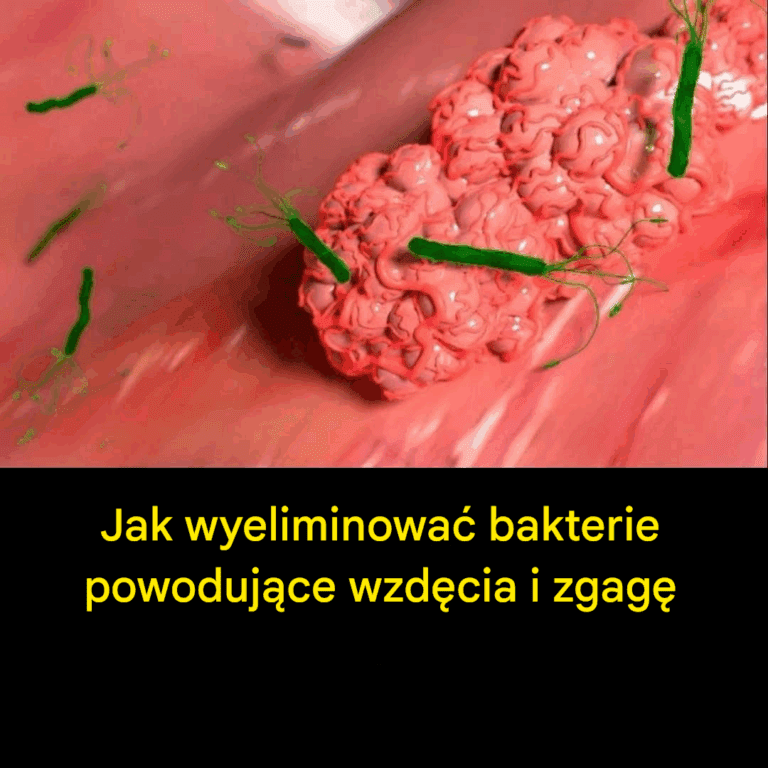Jak_naturalnie_wyeliminowa__bakterie_H__Pylori_odpowiedzialne_za_zgag__i_wzd_cia