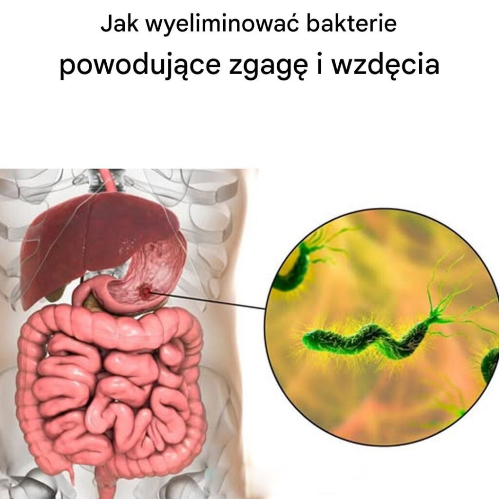 Jak_wyeliminowa__bakterie_powoduj_ce_zgag__i_wzd_cia Jak_wyeliminowa__bakterie_powoduj_ce_zgag__i_wzd_cia