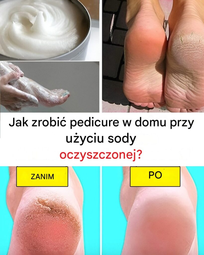 Jak_zrobi__pedicure_w_domu_przy_u_yciu_sody_oczyszczonej_