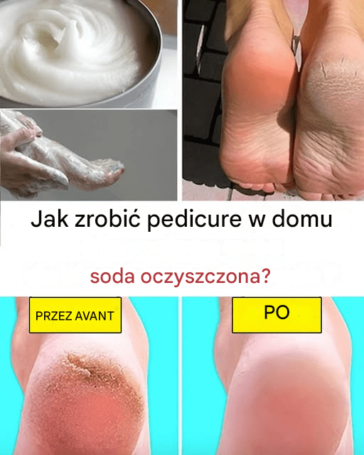 Jak_zrobi__pedicure_w_domu_przy_u_yciu_sody_oczyszczonej_ Jak_zrobi__pedicure_w_domu_przy_u_yciu_sody_oczyszczonej_