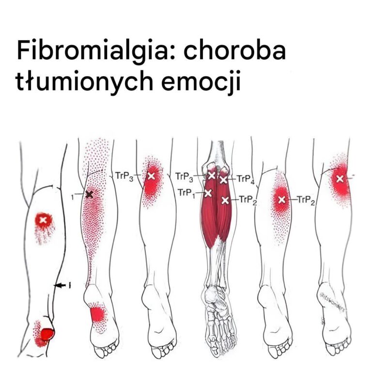Jaki_jest_zwi_zek_pomi_dzy_fibromialgi__a_emocjami_