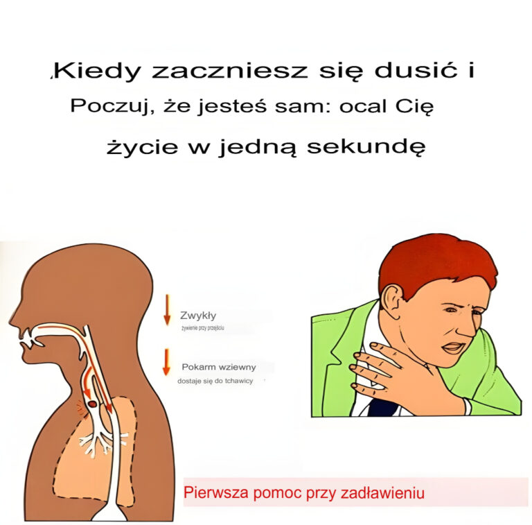 Je_li_zaczniesz_si__dusi__i_jeste__sam__uratuj_sobie__ycie_w_ci_gu_jednej_sekundy