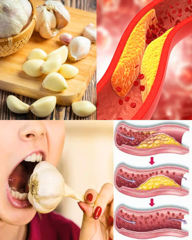 Jedzenie_surowego_czosnku_ka_dego_dnia__naturalny_spos_b_na_wsparcie_zdrowia_serca_i_obni_enie_poziomu_cholesterolu